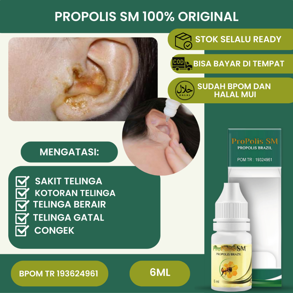 Obat Tetes Telinga Gatal Berair, Obat Telinga Gatal, Obat Congek, Obat Sakit Telinga, Obat Infeksi P