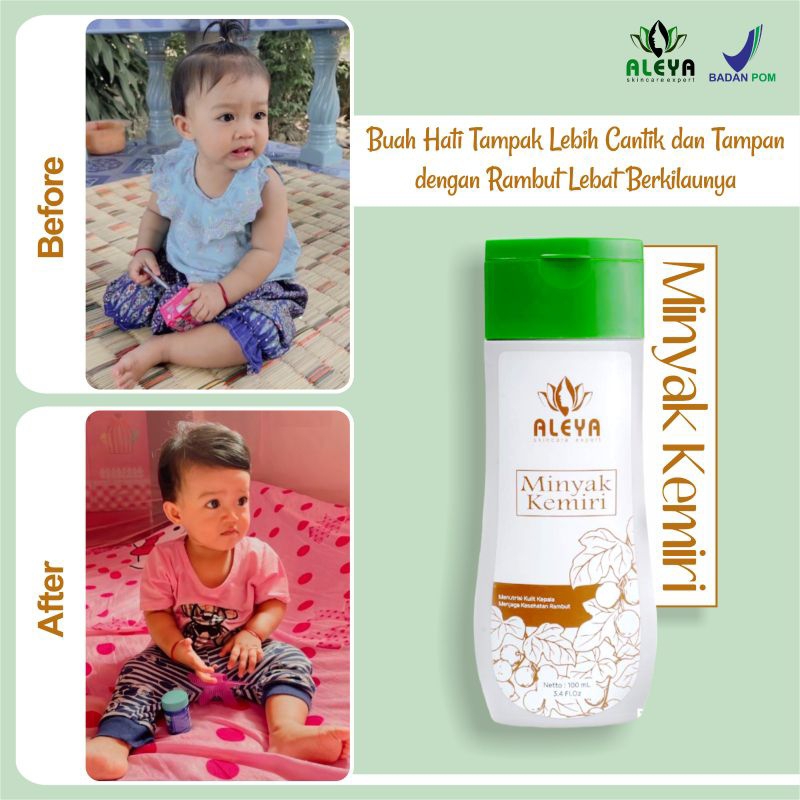 Minyak Kemiri Ibu Dan Anak Aleya Penyubur Rambut Bayi Penyubur Alis Penumbuh Rambut Kemiri FORA