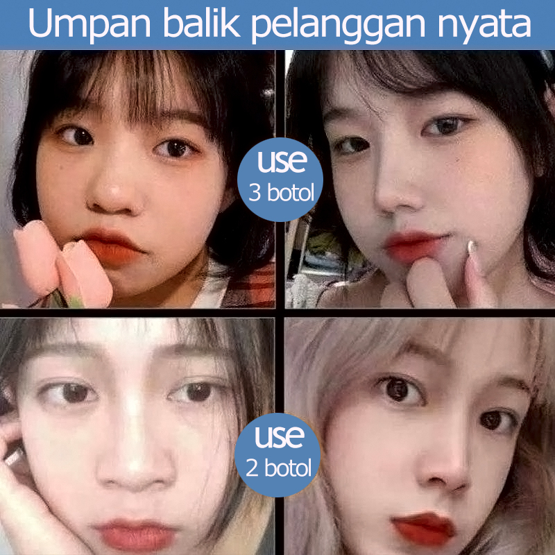 Alat Hidung Pemancung Minyak Esensial Pemancung Hidung Minyak Esensial Hidung 10ml Pemancung Hidung Nose Lift Up Essential Oil Minyak Esensial Pemancung