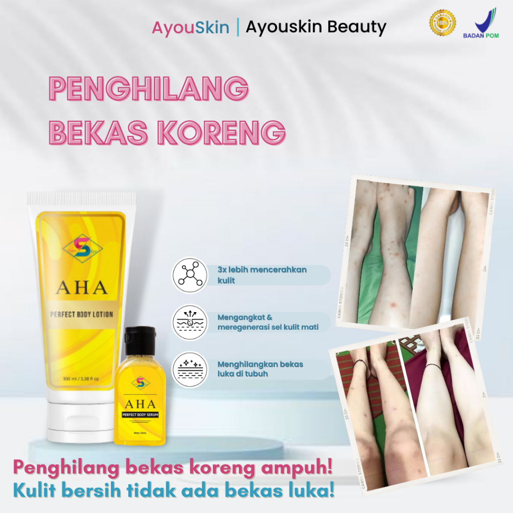 krim cream penghilang bekas koreng ampuh, Paket penghilang bekas luka garuk, penghilang bekas luka l