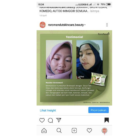 BROTOWALI MASKER LULUR ROROMENDUT Masker Jerawat 20 Gram