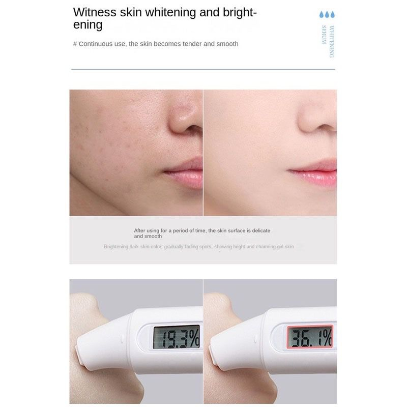 YOUBUY Whitening Dark Spot &amp; Freckle Glow Serum - pencerah flek bintik wajah