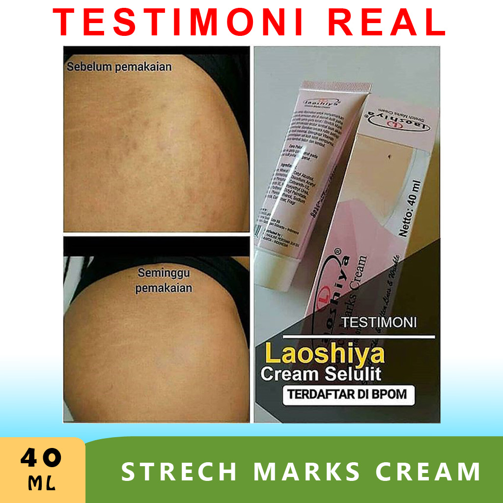 Cream obat Penghilang strechmark stretch mark cream paling ampuh BPOM