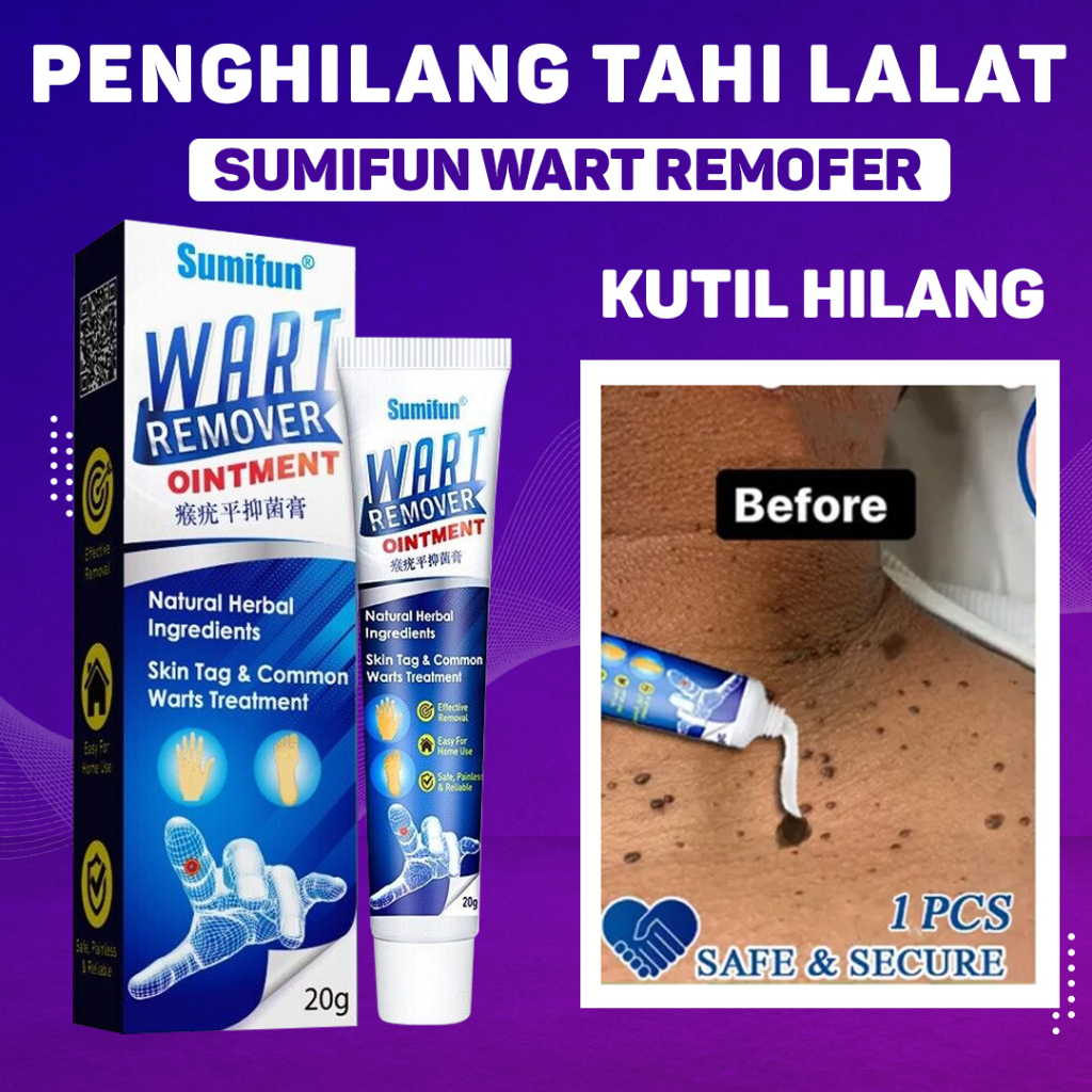 SUMIFUN Wart Remover Ointment alat obat penghilang kutil penghilang tahi lalat obat kutil di leher obat menghilangkan tahi lalat obat tahi lalat penghilang wart remover menghilangkan bekas luka wart remover pembersih kutil