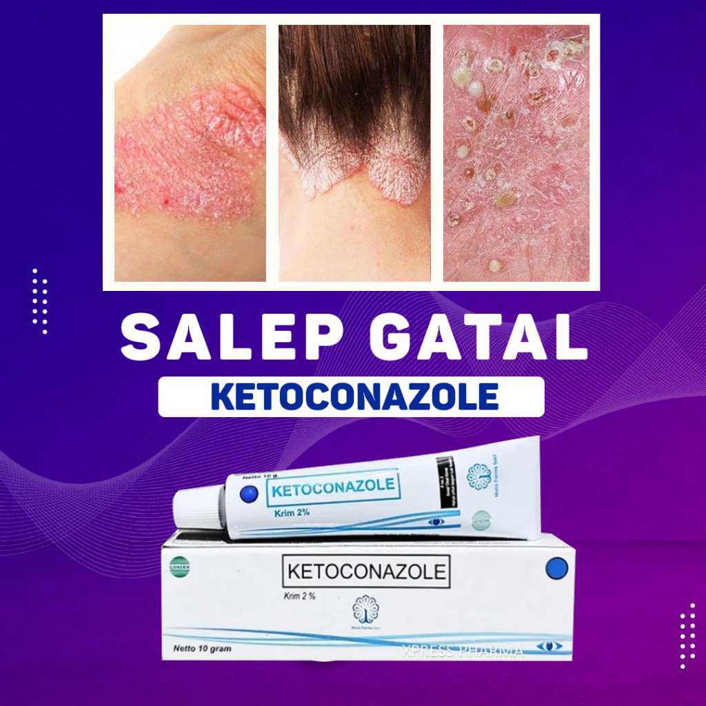 KETOCONAZOLE CREAM SALEP