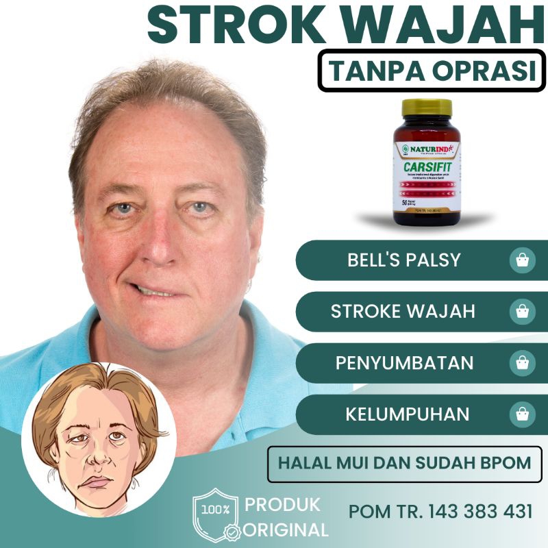 Obat Herbal Stroke Ampuh Lumpuh Susah Bicara Penyumbatan Otak Syaraf Setrok Strok Wajah Sebelah Kanan