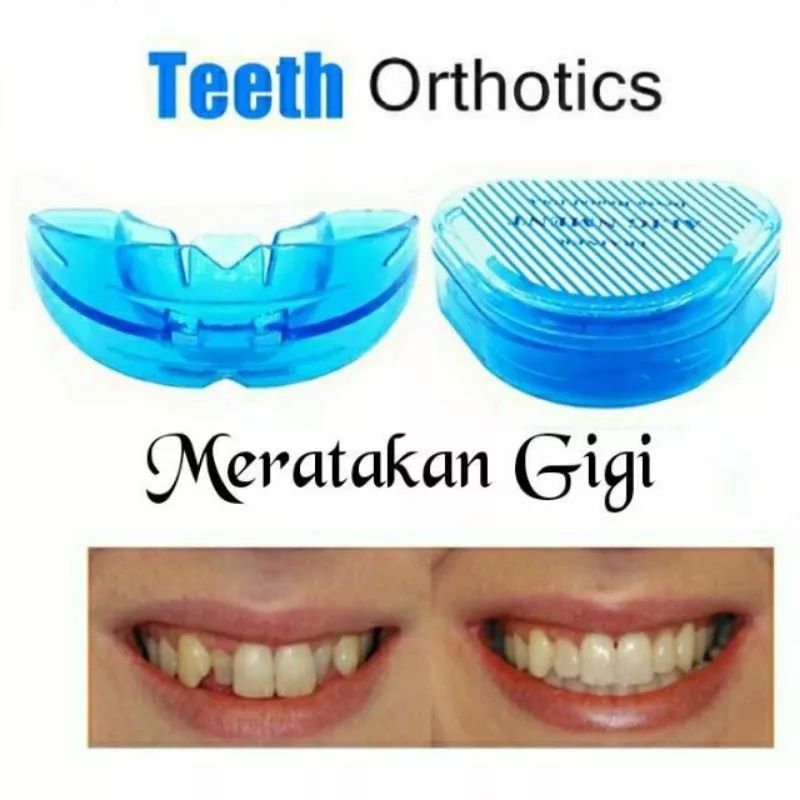 Perapih Gigi Gingsul Tonggos Alat Perata Gigi Original