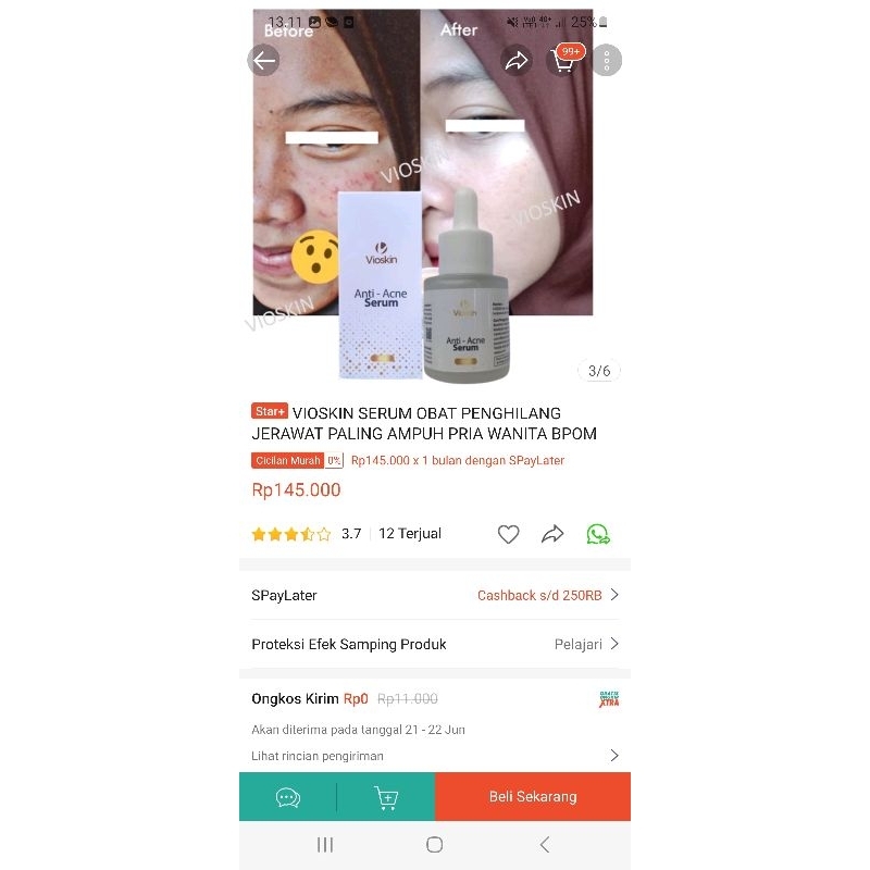 VIOSKIN SERUM OBAT PENGHILANG JERAWAT PALING AMPUH PRIA WANITA BPOM