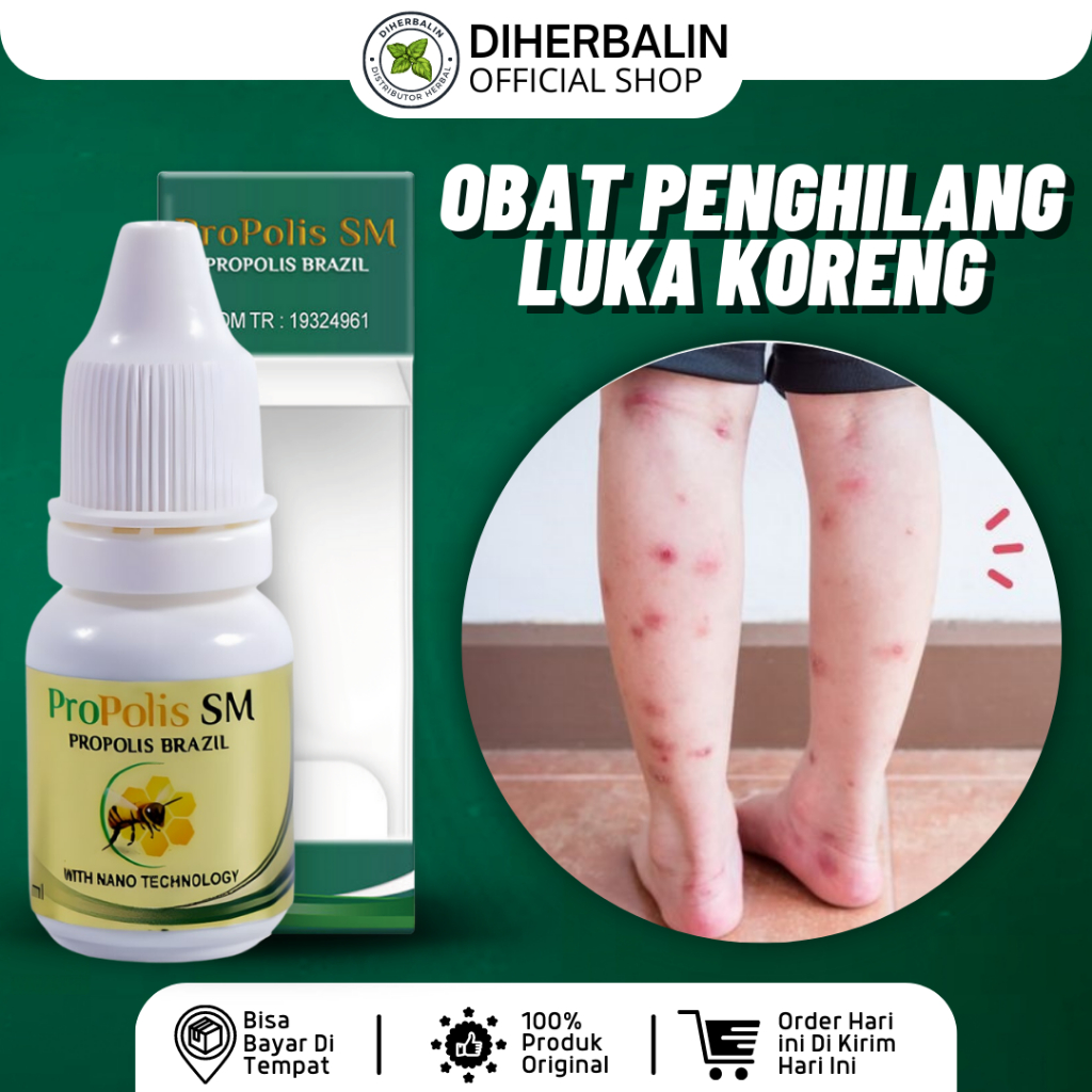 ProPolis SM 6ml - Obat Koreng, Obat Koreng Di Kaki, Penghilang Bekas Luka Hitam Koreng, Penghilang B