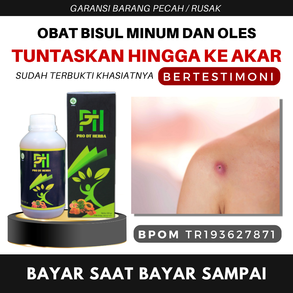 Obat Bisul Di Punggung Penghilang Bisul Permanen Non Minyak Oles Minum Paling Ampuh Bpom Pro DT Ori 