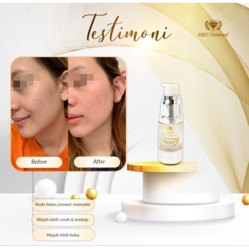 pesanan peeling glow serum plus serum acne glow (cs Naura)