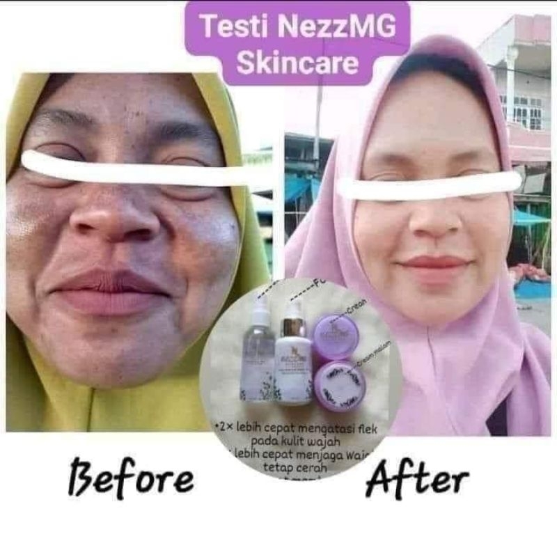 Nezzmg skincare platinum brightening