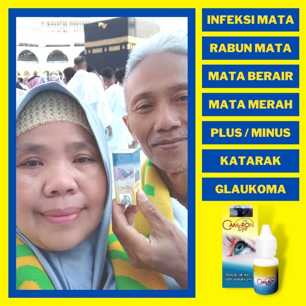 THE CAMERON EYE / OBAT TETES MATA  / TETES MATA TERBAIK / GURAH MATA HERBAL