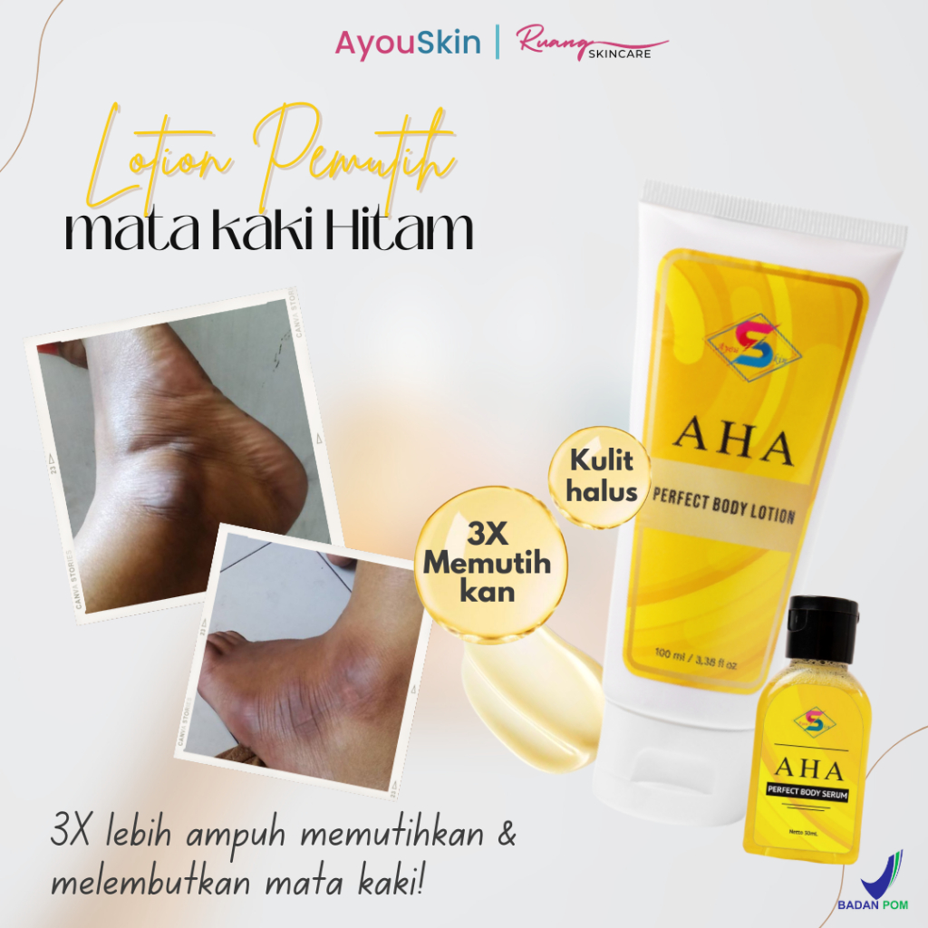 Pemutih mata kaki hitam Ampuh, Krim pemutih mata kaki gelap dan kering, Lotion pemutih dan pelembab 