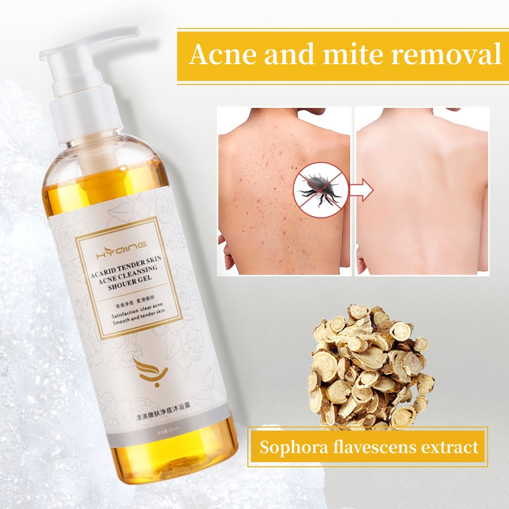 Acne Body Wash 260ml/ Whitening Body Wash / 100% herbal / Parfum Alami Shower Gel / Repair Skin / Jerawat Kulit / Gatal Antibakteri, menghilangkan tungau