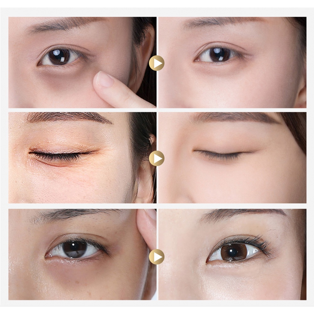 Masker Mata Bioaqua Kantung Mata Anti Aging ALLPHV Retinol