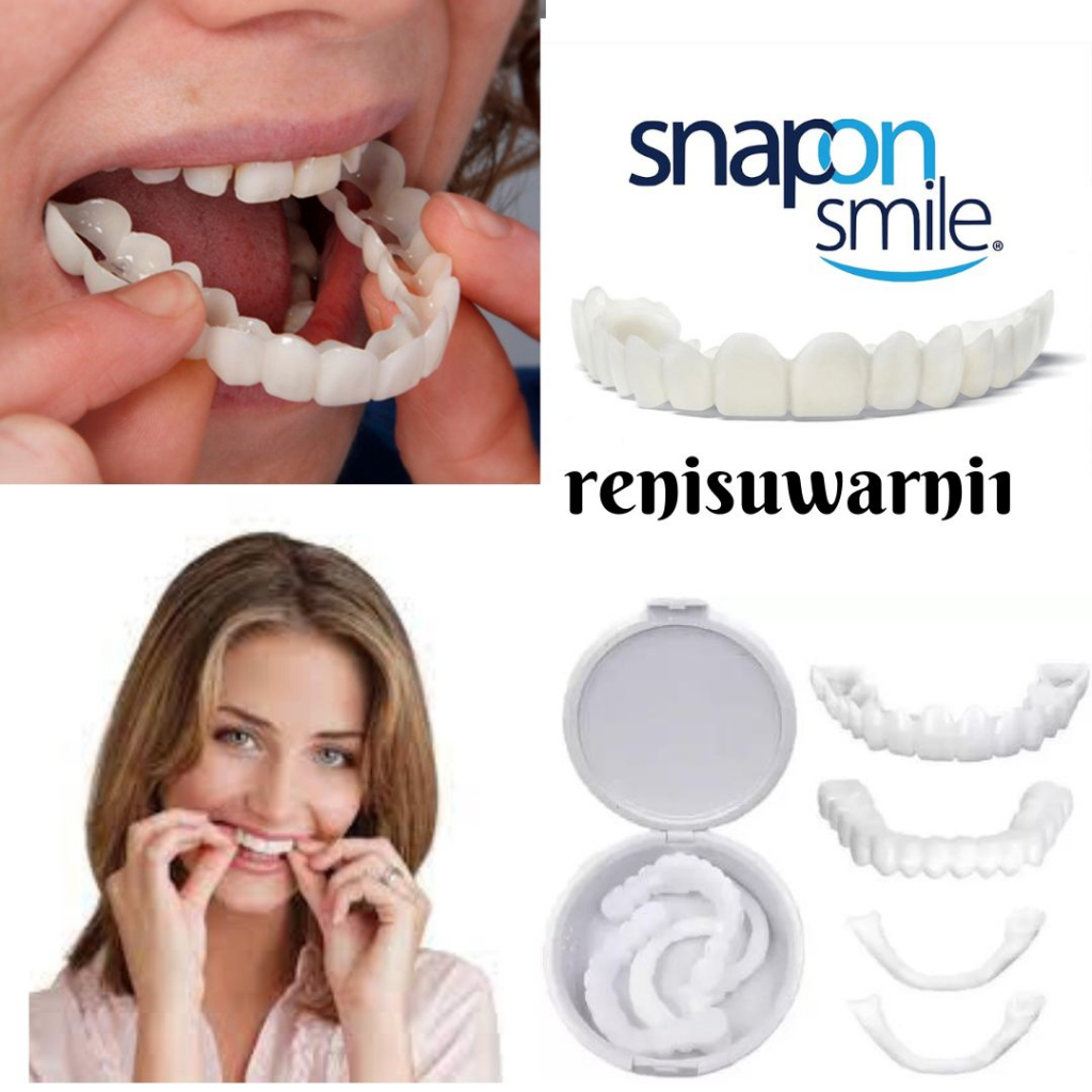 ❤renisuwarni1❤ Snap On Smile Authentic Gigi Palsu Snapon Instan Teeth Behel Perfect / GIGI PASANGAN 