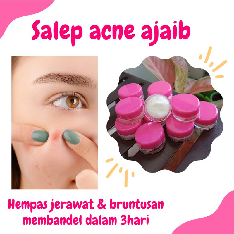 SALEP ACNES PENGHILANG JERAWAT DAN BEKAS JERAWAT salep jerawat dan bekas jerawat paling ampuh