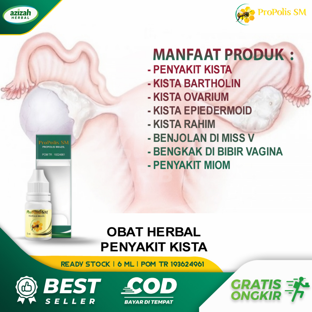 Obat Kista Bartholin Ovarium Epidermoid Endometriosis Miom Uteri
Benjolan Di Miss V Bengkak Vagina Polip Rahim Kanker Serviks Propolis
SM Brazil