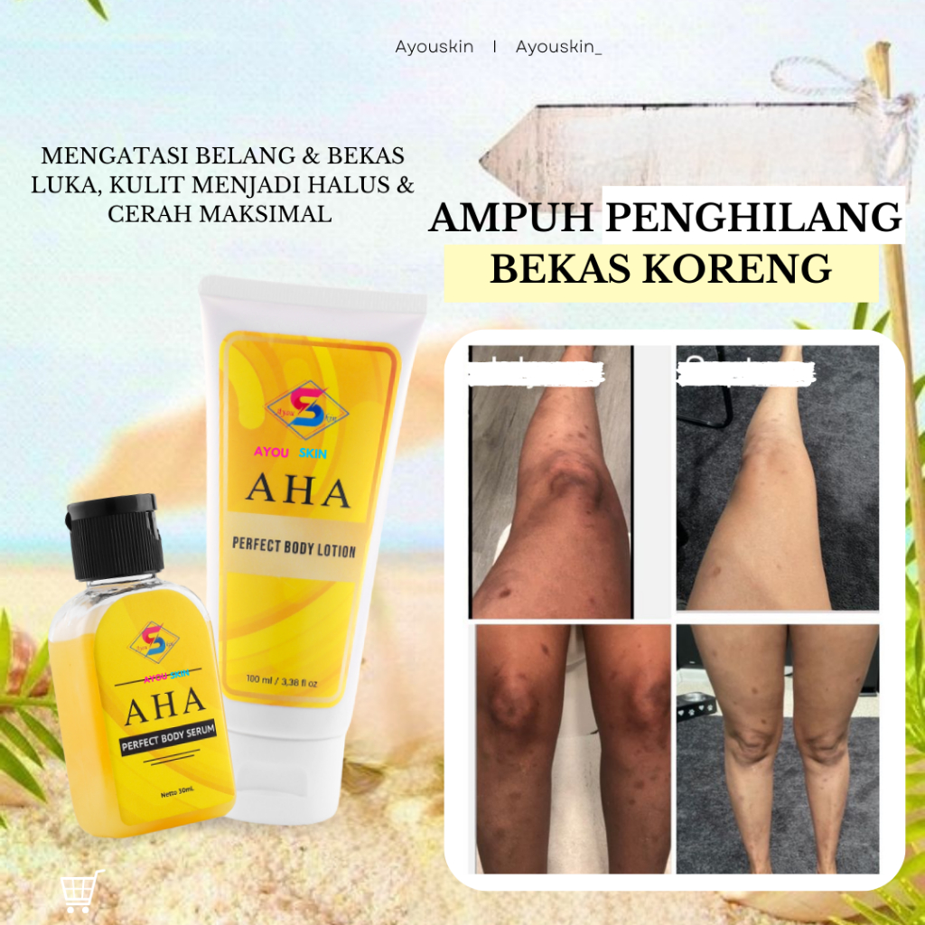 Cream Krim Penghilang Bekas Korengan, Penghilang Bekas Luka Lama, Menghilangkan Bekas Luka Korengan 