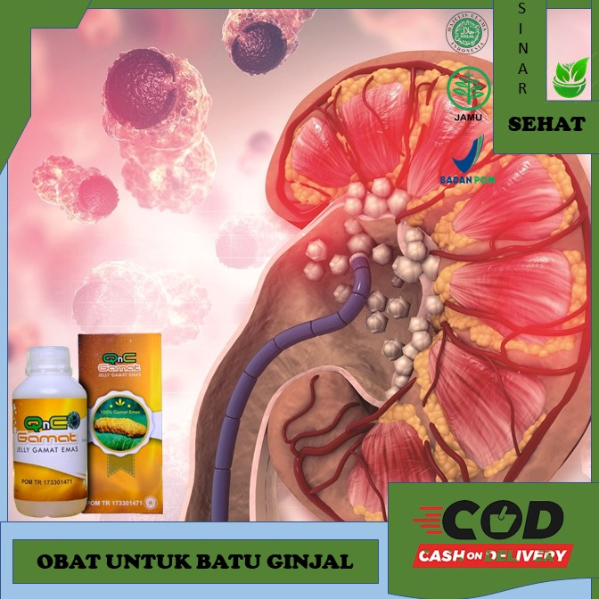 obat batu ginjal QnC Jelly Gamat - Obat Batu Ginjal Obat Penghancur Batu Ginjal, Obat Penghancur Bat