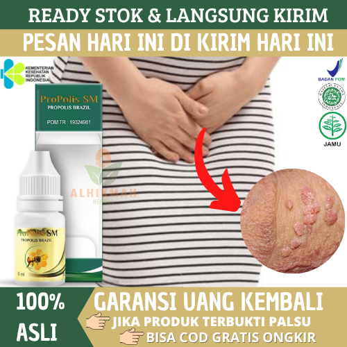 Obat Kutil Kelamin HPV, Obat Oles Kutil, Obat Perontok Kutil Kelamin pada Kelamin Pria dan Wanita - 