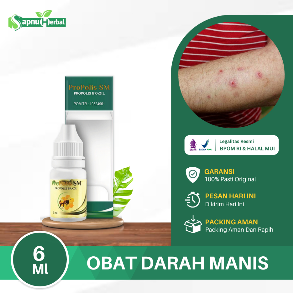 Obat Penyakit Darah Manis Gatal Gatal Kulit Peradangan Kulit Ruam Merah Kulit Gatal bernanah herbal 