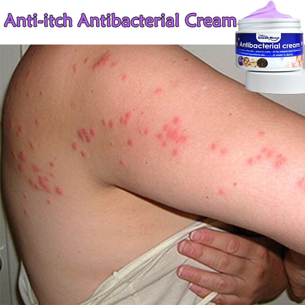 salep gatal paling ampuh Obat Gatal Kulit salep eksim kering menahun salep psoriasis gatal kulit her