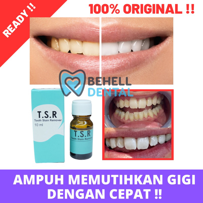 CAIRAN AMPUH PEMUTIH GIGI TSR TOOTH STAIN REMOVER - PENGHILANG PEMBERSIH PELUNAK PLAK KARANG GIGI - Penghilang Bau Mulut