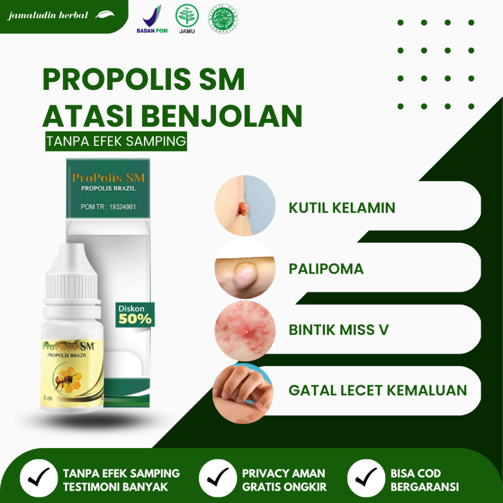 Obat Oles Penghancur Lipoma, Benjolan, Tiroid, Gondok, Bisul | Propolis SM Asli 100% Original