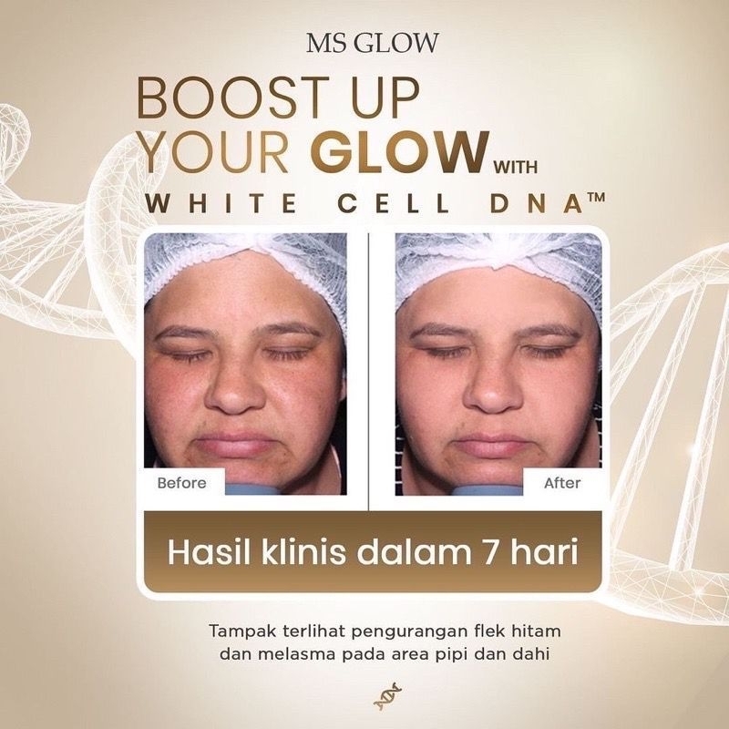 PAKET WAJAH WHITE CELL DNA, SERUM DNA, NIGHT DNA UNTUK FLEK BANDEL