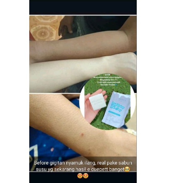 SABUN SUSU NORCA , SABUN PEMUTIH, SABUN KORENG BEKAS LUKA, WHITENING SOAP NORCA BEAUTE