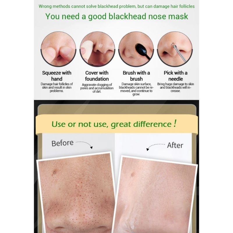 BLACK HEAD REMOVER CAIR SACHET MASKER KOMEDO HIDUNG Berminyak