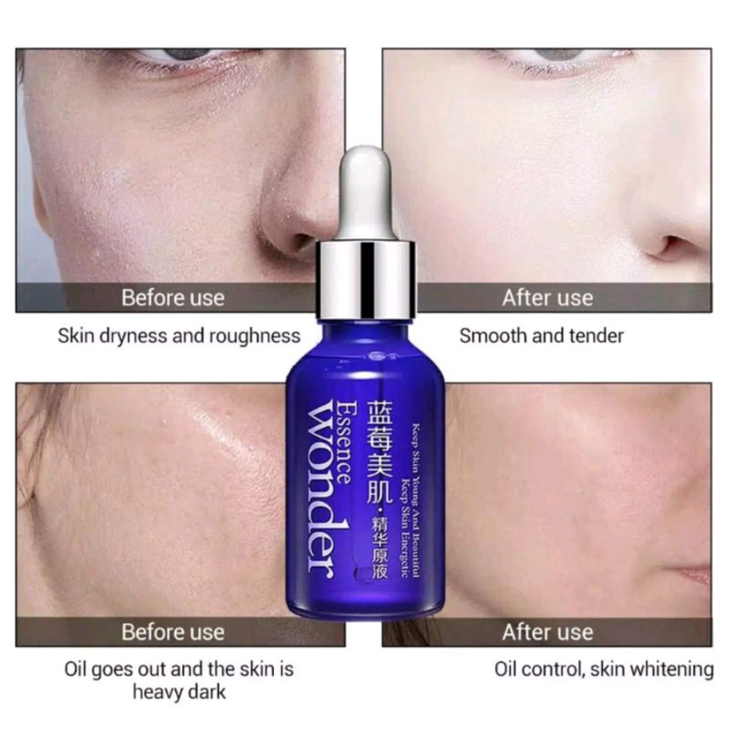 Blueberry Serum Flek Melasma Pemutih Wajah Extra Cepat Serum Glowing Penghilang Flek Membandel Penghilang Jerawat Serum Wonder Memutihkan