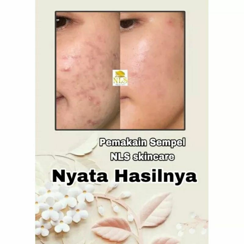 NLS Skincare Bpom 100%