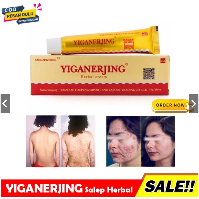 [ORI] Salep Herbal YIGANERJING Obat Eksim &amp; Jamur Jerawat pada Kulit