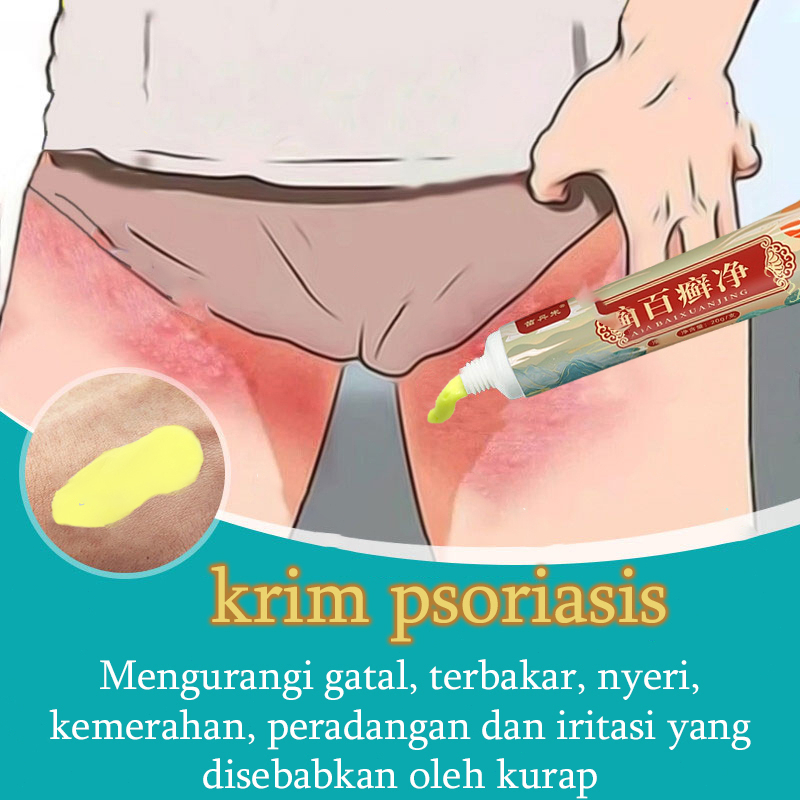 Obat Gatal Salep Obat Gatal Kulit Krim Gatal 20ml Salep antibiotik psoriasis antibakteri gatal krim krim dermatitis dan psoriasis psoriasis eksim eksim antid gatal salep