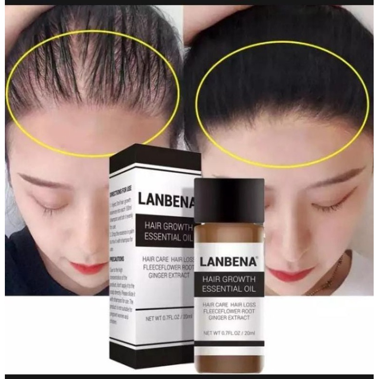 [ORI] Lanbena Serum Penumbuh Rambut &amp; Mencegah Kebotakan - Hair Growth Essential Oil 100% Original