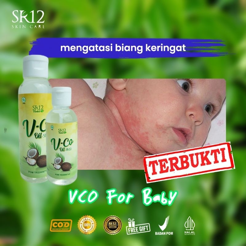 (GRATIS HADIAH) VCO SR12 Untuk Ruam Popok Bayi Biang Keringat Minyak Kelapa Untuk Bayi VCO untuk Bay