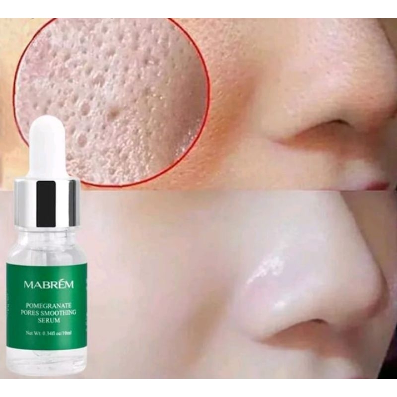 TERBUKTI AMPUH CLB GLOW ORIGINAL DGN CEPAT MEMUTIHKAN KULIT WAJAH,FLEK,KUSAM,JERAWATAN DAN GLOWING