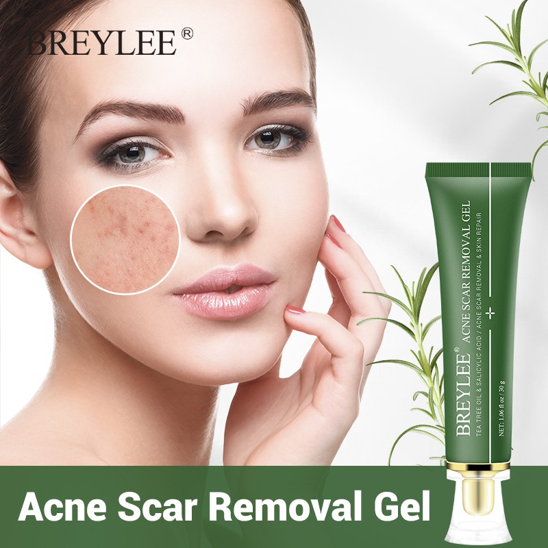 ✨ AKU MURAH ✨BREYLEE Tea Tree Acne Marks Gel / Gel Memudarkan Bekas Jerawat &amp; Memperbaiki Kulit Wajah