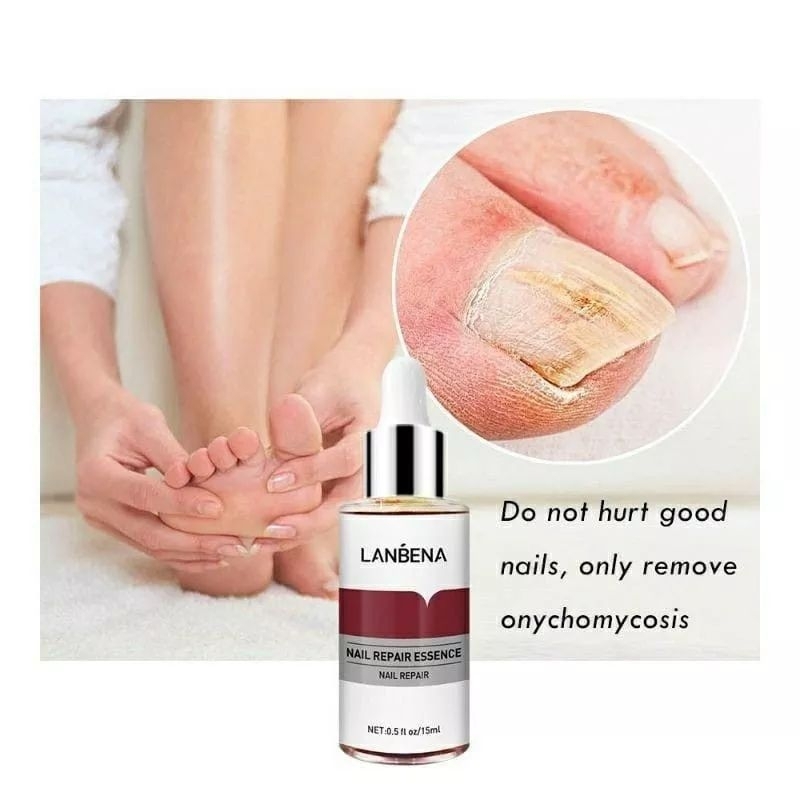  READY  LANBENA nail repair essence SERUM KUKU LANBENA / SERUM JAMUR JUKU