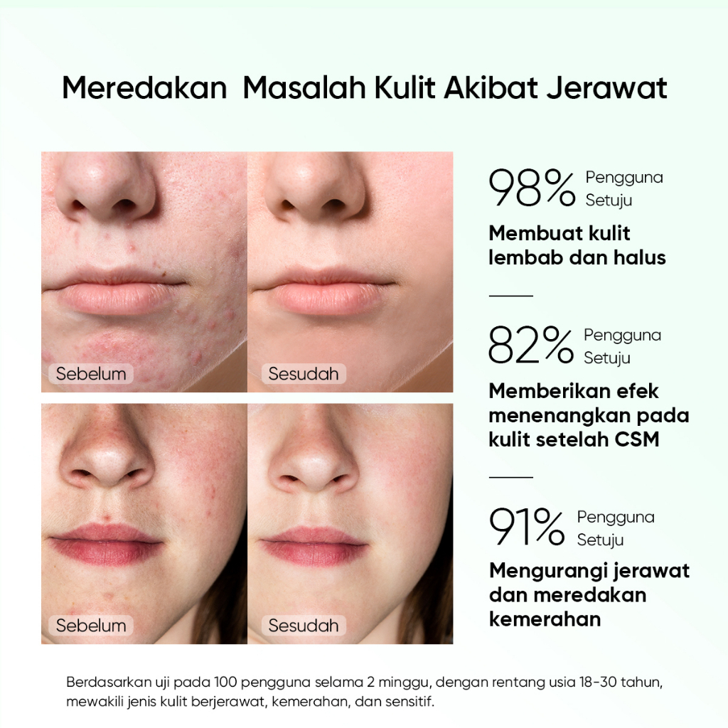 SKINTIFIC Pure Centella Acne Calming Toner Jerawat Meredahkan Jerawat Merah