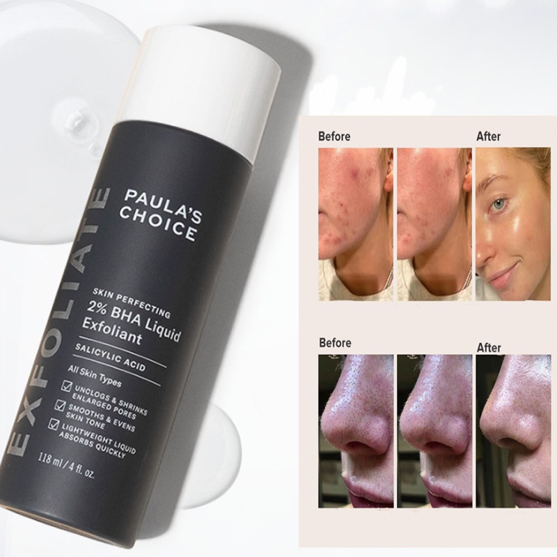 Paula's Choice Skin Perfecting 2% BHA Liquid Exfoliant - 118ml ( Paulas Choice 2% bha Toner Exfoliant) Mencegah Jerawat /Acne