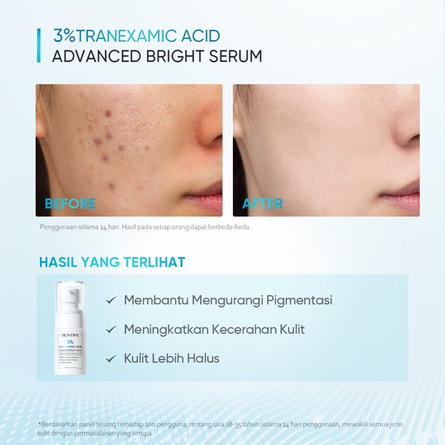 Skintific 3% Tranexamic Acid Advanced Bright Serum