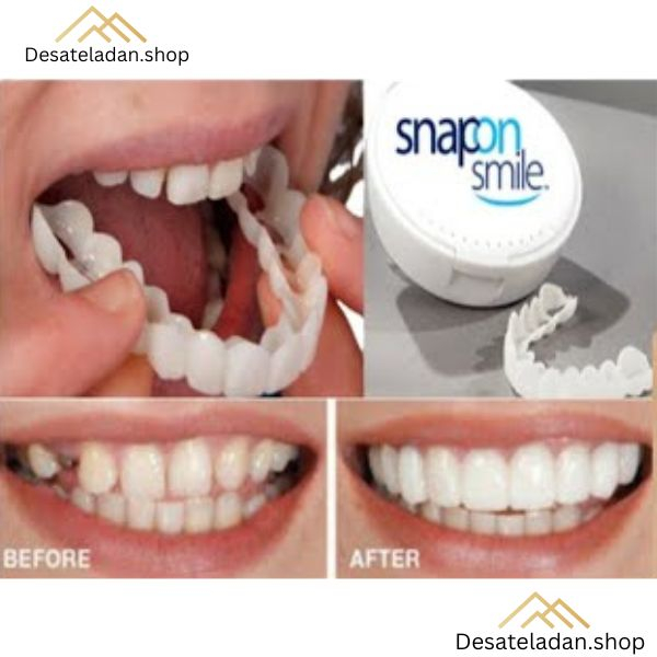COD ✨ Snap On Smile 1 Set Sepasang Gigi Atas Dan Bawah Original 100% / Venner Gigi / Pemutih Gigi Atas Bawah