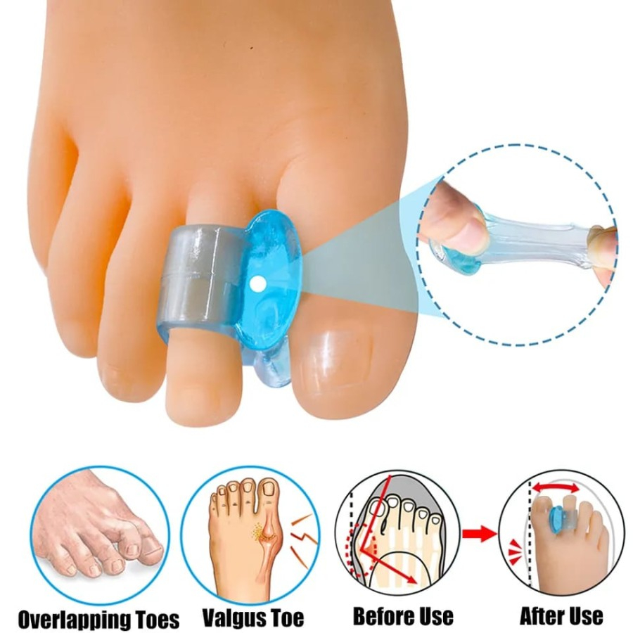 Bunion Corrector and Bunion Splint for Bunion Relief Bunion Toe