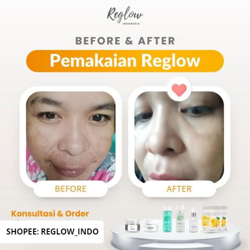 Paket Reglow Untuk Flek Hitam Facial Wash + Serum + Day Cream