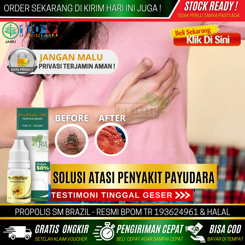 Obat Payudara Bengkak Besar Sebelah, Cenang Dan Borok Di Payudara Wanita, Linu Ngilu, Obat Abses Pay