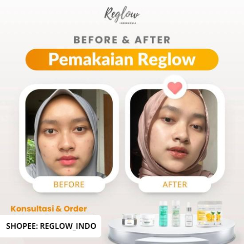 Skin Care Reglow dr Shindy Putri 1 Paket Lengkap Murah Pemutih Wajah Glowing Whitening Ampuh Untuk Kulit Berminyak Berjerawat Dan Bruntusan Penghilang Flek Hitam Membandel Reg glow Original Official